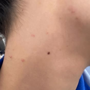 Yves Rocher Yüz Yıkama Jeli Cildimi Mahvetti