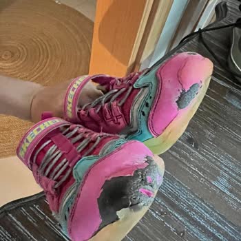 Skechers Ayakkabılarının Kısa Ömrü Ve Yetersiz Müşteri Hizmeti