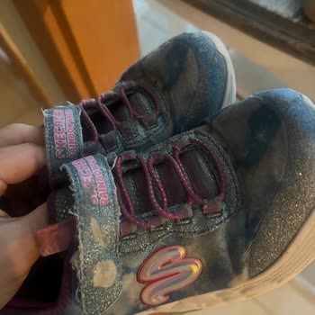 Skechers Ayakkabılarının Kısa Ömrü Ve Yetersiz Müşteri Hizmeti