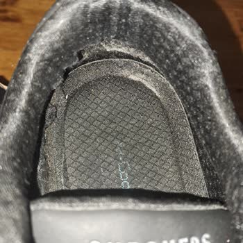 Skechers Ayakkabının İç Astar Sorunu Ve Müşteri Hizmetleri