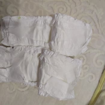 Sleepy Bebek Bezinde Kalite Sorunu Ve Cilt Tahrişi
