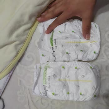 Sleepy Bebek Bezinde Kalite Sorunu Ve Cilt Tahrişi