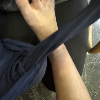 LCW Çorapları Çocuğumun Vücudunu Boyadı
