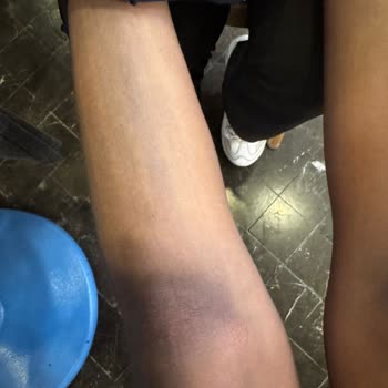 LCW Çorapları Çocuğumun Vücudunu Boyadı