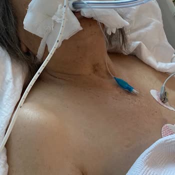 Reyap Hastanesi'nde Yaşanan Trajik Olay Ve Şikayetler