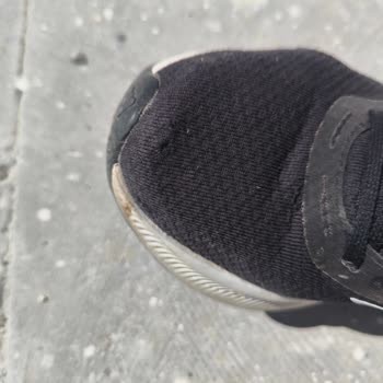 In Street Adidas Ayakkabıda Erken Deformasyon Ve Hatalı İnceleme!