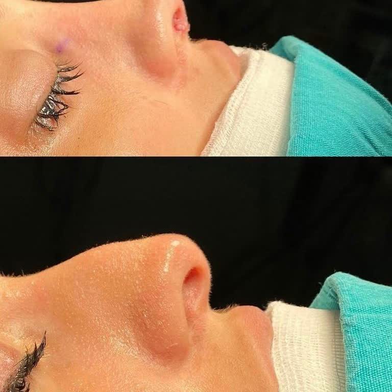 Doğa Hospital Estetik Ameliyatı Sonrası Özgüvenimi Kaybettim!