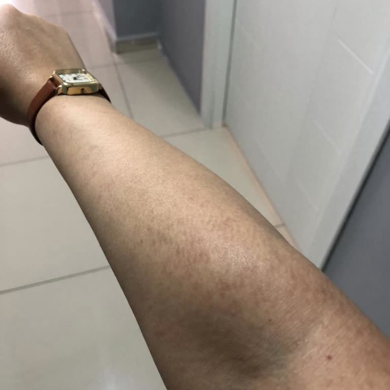 Burdur Güzellik Merkezi'nde Hayal Kırıklığı