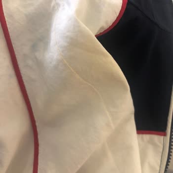 Bershka Ceketimde Renk Değişimi Ve Sararmalar