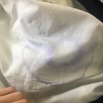 Bershka Ceketimde Renk Değişimi Ve Sararmalar