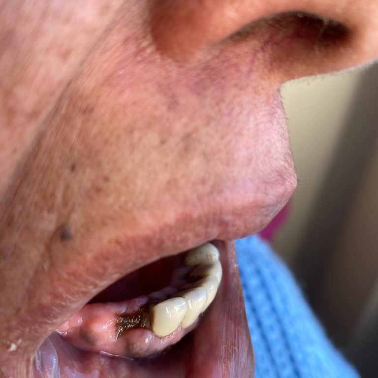 İnkadent Yanlış Tedavi Sonucunda Mağduriyet Yaşıyoruz!