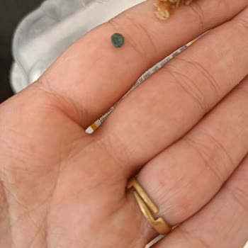 BİM'de Satılan Köfteden Taş Çıkması