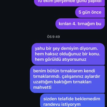 Sürekli Değişen Tecrübesiz Çalışanlar Ve Kırılan Tırnaklar