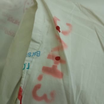 Hastane Temizliği Ve Hijyen Sorunları