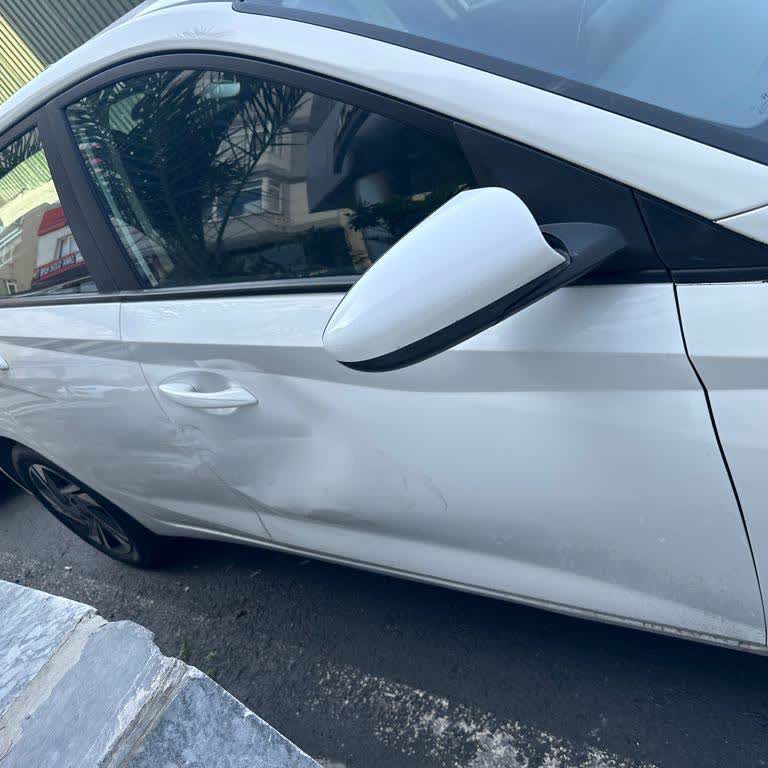 Haksız Hasar İddiası Ve Şeffaf Olmayan İşlemler