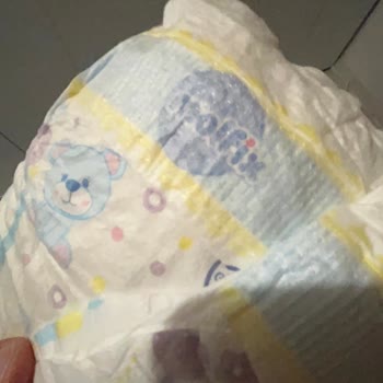 Molfix Bebek Bezinde Kimyasal Koku Şoku