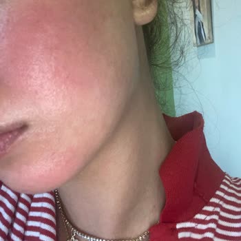 Sephora Laneige Şikayeti