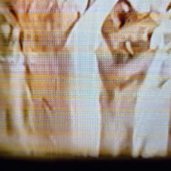 Arçelik Televizyonun Kronik Ekran Sorunu Ve Yüksek Tamir Ücreti