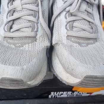 Skechers Ayakkabımın Beklenmedik Yıpranması