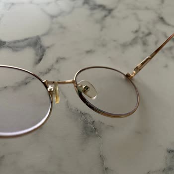 Gözlükler Yeşil Boya Sorunu Ve Yetersiz Müşteri Hizmeti