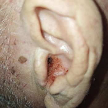 Doktorun İhmali: Babamın Sağlığı Tehlikede