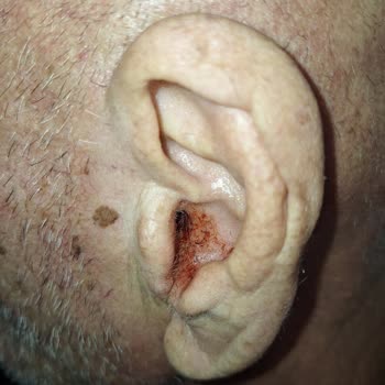 Doktorun İhmali: Babamın Sağlığı Tehlikede