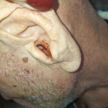 Doktorun İhmali: Babamın Sağlığı Tehlikede