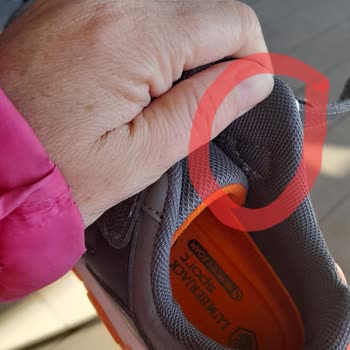 Oğlumun Ayakkabıları Bileklerini Acıttı