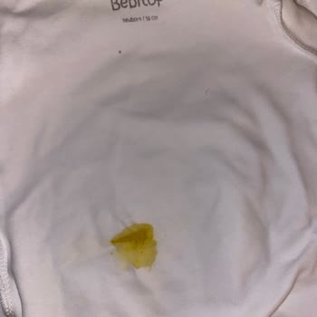 Molfix Bezlerde Sürekli Taşırma Sorunu