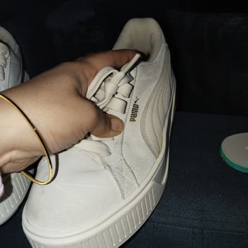 Ayakkabının Renk Değişimi Ve Rahatsızlık Sorunu