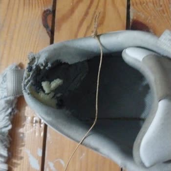 Adidas Ayakkabıda Erken Aşınma Ve Trendyol'un İlgisizliği