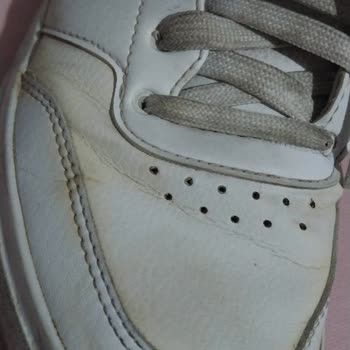 Adidas Ayakkabıda Erken Aşınma Ve Trendyol'un İlgisizliği