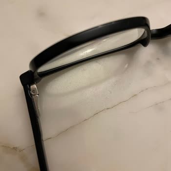 Dünyagöz Optik Hizmetlerinde Hayal Kırıklığı Ve Kalitesizlik