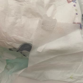 Hatalı Bebek Bezi İle Karşılaştım