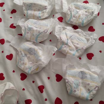 Defolu Bebek Bezi Sorunu