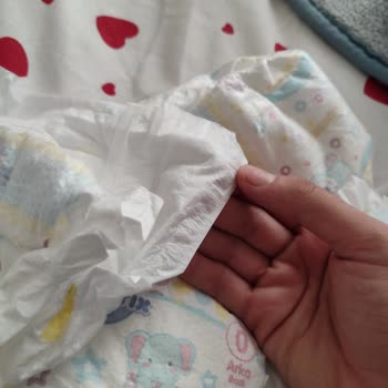 Defolu Bebek Bezi Sorunu