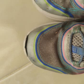 Skechers Ayakkabılarında Kalite Sorunu Ve Yetersiz Müşteri Hizmetleri