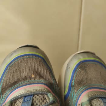 Skechers Ayakkabılarında Kalite Sorunu Ve Yetersiz Müşteri Hizmetleri