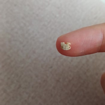 Found a Snail in Kellogg's Red Berry Cereal – Requesting Immediate Action