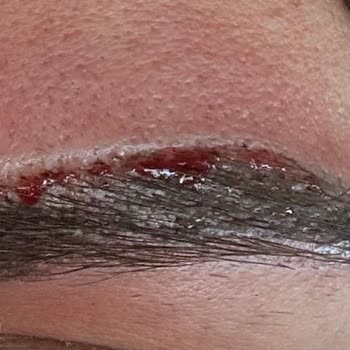 Heaven Deluxe (Uşak) 'ta Kaş Faciası Ve Yanıltıcı Hizmet