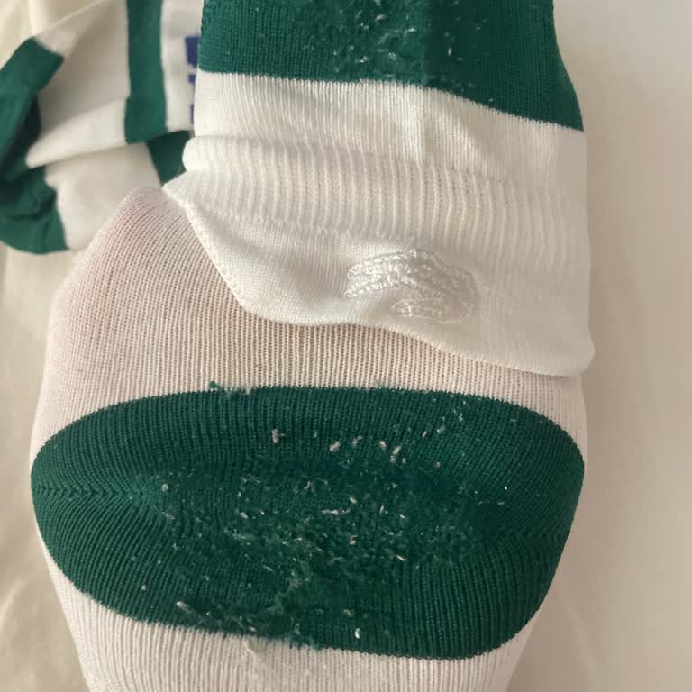 Lacoste Çorabında Hayal Kırıklığı: Kalite Beklentisi Karşılanmadı