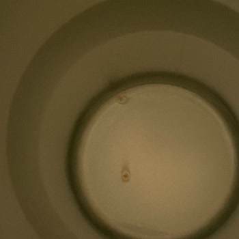 Stanley Termos Küf Sorunu: Çocuğumun Sağlığı Tehlikede