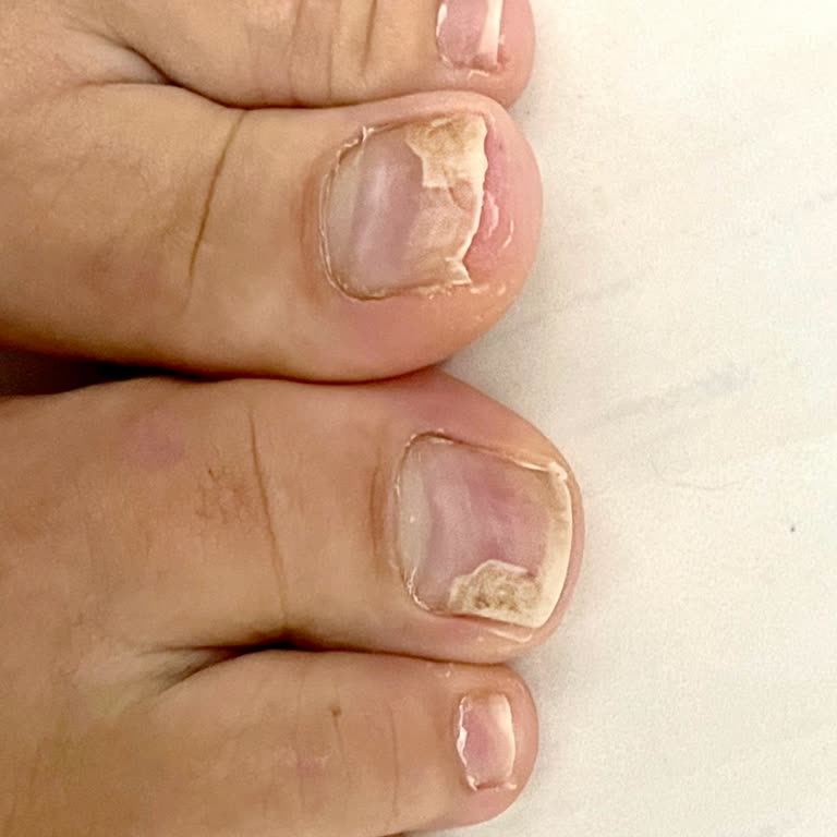 Ebru Ergün Beauty Beylikdüzü Hijyen Sorunları