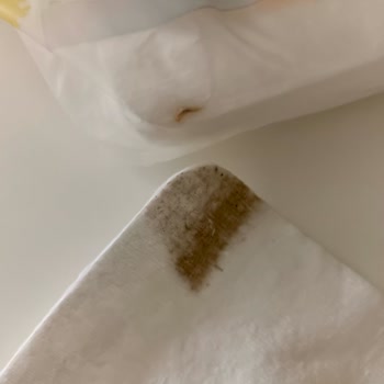 Bebek Pamuğu Üretiminde Hijyen Sorunları