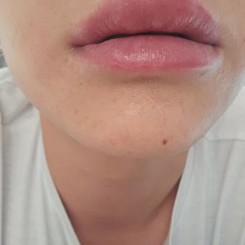 Bk Aesthetic | Berke Kılıç Etkisiz İşlem