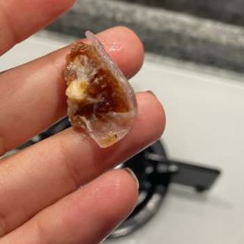 Kuruyemişteki Cam Tehlikesi: Acil Servis Yolculuğu