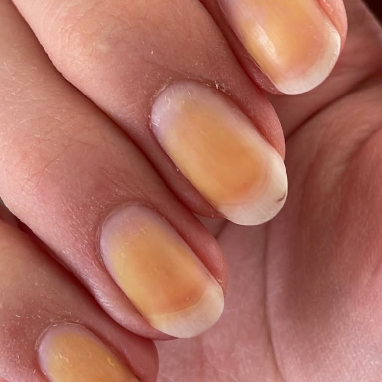 Flormar Ojesi Tırnaklarda Kalıcı Leke Bırakıyor