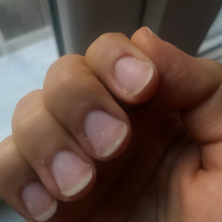 Nezaketsiz Hizmet Ve Kötü Manikür Deneyimi