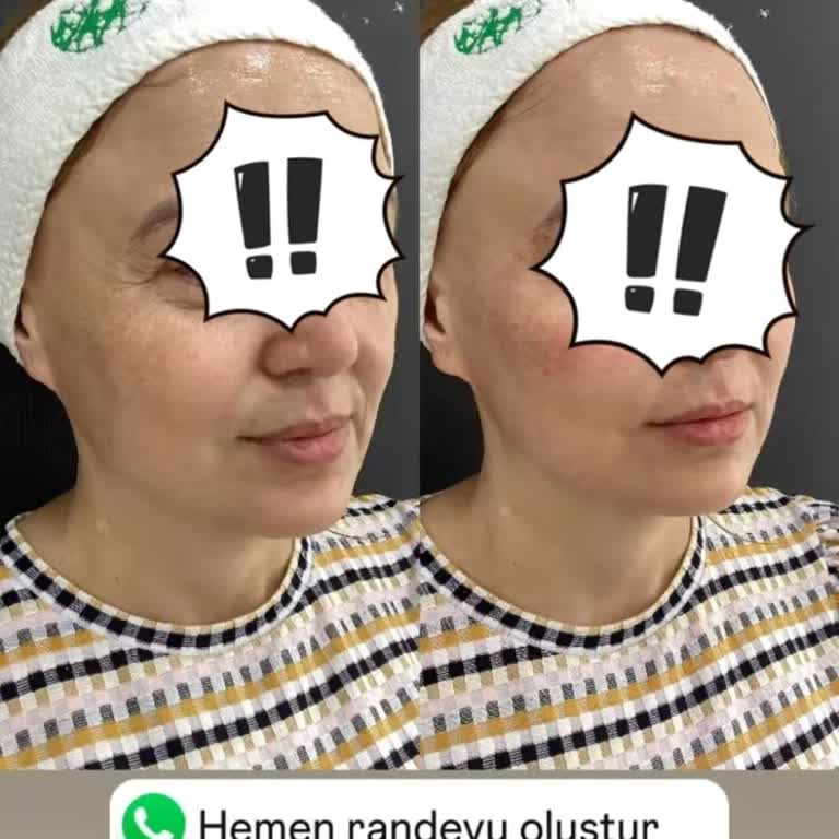 Başarısız Güzellik İşlemi Ve İade Sorunu