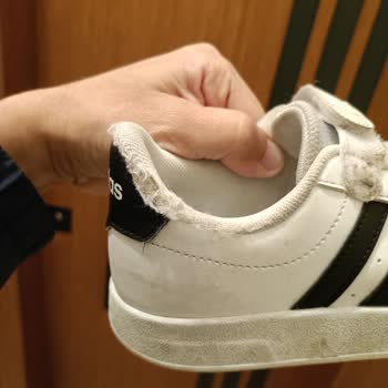 Adidas Ayakkabıda Hızlı Deformasyon Ve Yetersiz Müşteri Hizmeti